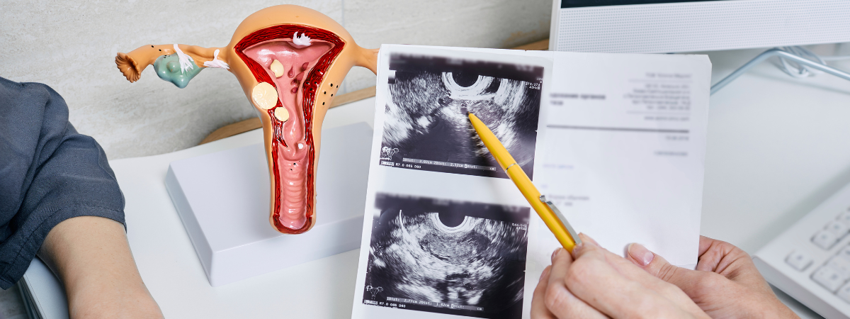 Gynecological Problems 1 Balance your hormones naturally with expert homeopathy in Dubai. Gentle, personalized treatment for women's health and well-being.