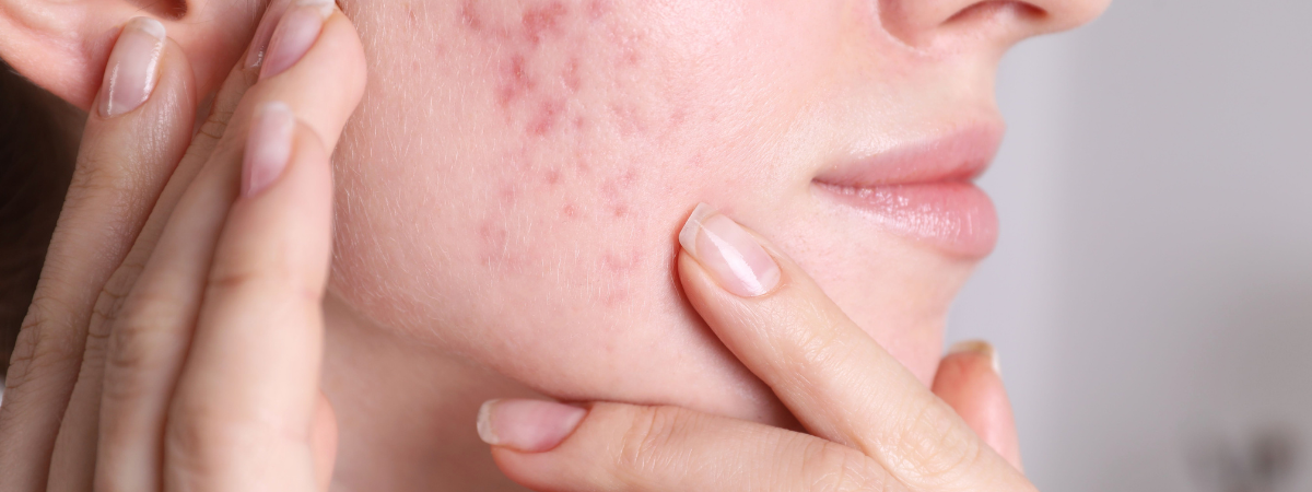 skin problems 1 5