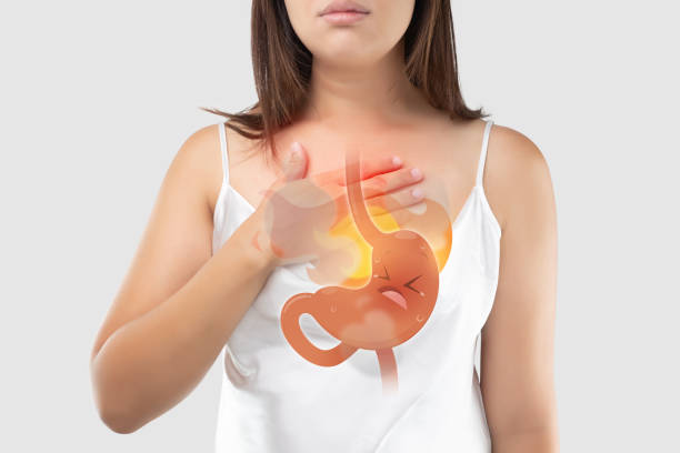 homeopathy treatment for acid reflux
